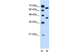 Western Blotting (WB) image for anti-Solute Carrier Organic Anion Transporter Family, Member 1A2 (SLCO1A2) (Middle Region) antibody (ABIN2781618)