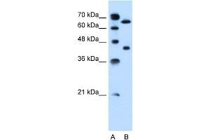WB Suggested Anti-SLCO1A2 Antibody Titration:  0. (SLCO1A2 Antikörper  (Middle Region))