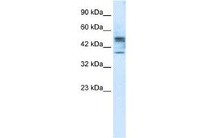 WB Suggested Anti-CHST4 Antibody Titration:  1. (CHST4 Antikörper  (Middle Region))