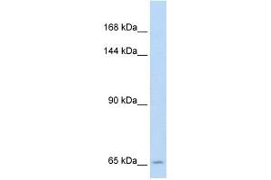 WB Suggested Anti-SLC19A1 Antibody Titration:  5. (SLC19A1 Antikörper  (N-Term))