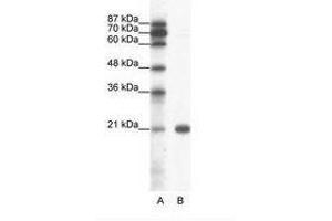 Image no. 1 for anti-Synovial Sarcoma, X Breakpoint 2 (SSX2) (C-Term) antibody (ABIN6736051) (SSX2 Antikörper  (C-Term))