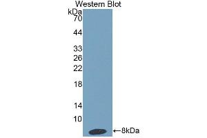 Western blot analysis of the recombinant protein. (HPR Antikörper  (AA 30-85))