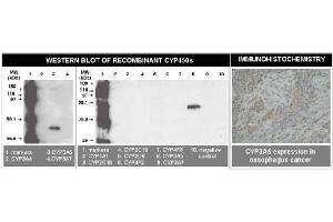 Immunohistochemistry (IHC) image for anti-Cytochrome P450, Family 3, Subfamily A, Polypeptide 5 (CYP3A5) (C-Term) antibody (ABIN264500) (CYP3A5 Antikörper  (C-Term))