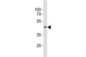 Western blot testing of EED antibody at 1:1000 dilution + mouse brain lysate; Predicted molecular weight: 50 kDa (isoform 1), 53 kDa (isoform 2), 46 kDa (isoform 3). (EED Antikörper  (N-Term))