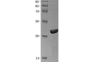 Western Blotting (WB) image for Thymopoietin (TMPO) (Transcript Variant 2) protein (His tag) (ABIN2733922)