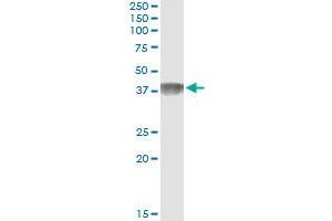 Immunoprecipitation of C4BPB transfected lysate using anti-C4BPB monoclonal antibody and Protein A Magnetic Bead , and immunoblotted with C4BPB MaxPab rabbit polyclonal antibody. (C4BPB Antikörper  (AA 1-251))