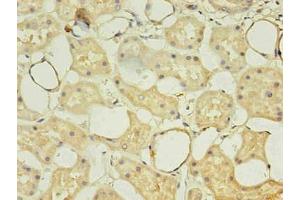 Immunohistochemistry of paraffin-embedded human kidney using  in 30 μg/mL dilute concentrations. (CD14 Antikörper)