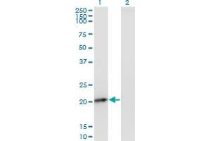 Western Blot analysis of PMVK expression in transfected 293T cell line by PMVK monoclonal antibody (M07A), clone 2B8. (PMVK Antikörper  (AA 1-192))