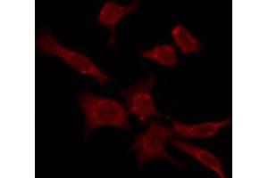 ABIN6276103 staining COLO205 by IF/ICC. (OPN4 Antikörper  (C-Term))