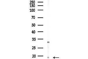Western blot analysis of lysates from PC12 cells(LPS 4h treatment), using p18 INK4c Antibody at 1/1000 dilution.