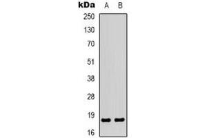 Western blot analysis of MYL9 expression in Jurkat (A), COLO205 (B) whole cell lysates. (MYL9 Antikörper  (N-Term))