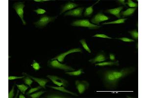 Immunofluorescence of purified MaxPab antibody to NCF4 on HeLa cell. (NCF4 Antikörper  (AA 1-339))