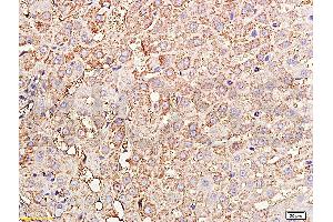 Formalin-fixed and paraffin embedded rabbit liver tissue labeled with Rabbit Anti-TIMP-1(NT) Polyclonal Antibody, Unconjugated (ABIN668331) at 1:200 followed by conjugation to the secondary antibody and DAB staining. (TIMP1 Antikörper  (AA 103-207))