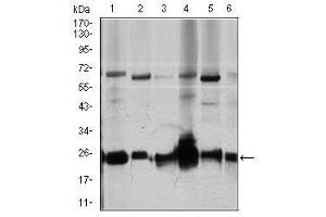 Image no. 3 for anti-rho GDP Dissociation Inhibitor (GDI) alpha (ARHGDIA) antibody (ABIN1500701) (ARHGDIA Antikörper)
