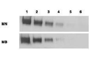 Western Blotting (WB) image for anti-Mesothelin (MSLN) (Extracellular Domain) antibody (ABIN400815) (Mesothelin Antikörper  (Extracellular Domain))