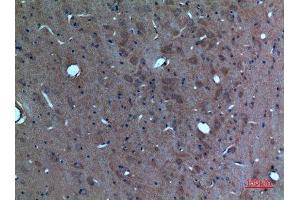 Immunohistochemistry (IHC) analysis of paraffin-embedded Rat Brain, antibody was diluted at 1:100. (SCG3 Antikörper  (N-Term))