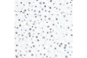 Immunohistochemistry of paraffin-embedded rat liver using SP1 Rabbit pAb (ABIN7270506) at dilution of 1:50 (40x lens). (SP1 Antikörper  (AA 420-620))