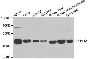 Western blot analysis of extracts of various cell lines, using PPM1A antibody. (PPM1A Antikörper  (AA 1-382))