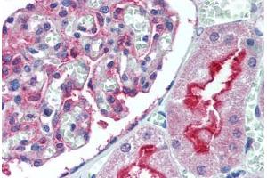 Human Kidney (formalin-fixed, paraffin-embedded) stained with ATG7 antibody ABIN305896 at 5 ug/ml followed by biotinylated goat anti-rabbit IgG secondary antibody ABIN481713, alkaline phosphatase-streptavidin and chromogen. (ATG7 Antikörper  (N-Term))