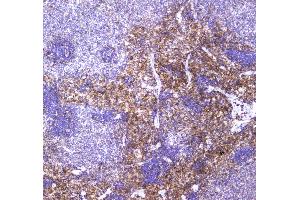 IHC analysis of VCAM1 using anti-VCAM1 antibody . (VCAM1 Antikörper  (AA 25-270))