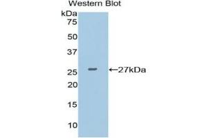 Detection of recombinant XRCC6 using Polyclonal Antibody to X-Ray Repair Cross Complementing 6 (XRCC6)