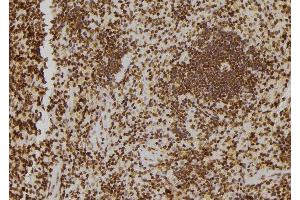 ABIN6277184 at 1/100 staining Rat spleen tissue by IHC-P. (TOLLIP Antikörper  (Internal Region))