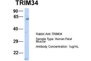 Host:  Rabbit  Target Name:  TRIM34  Sample Type:  Human Fetal Muscle  Antibody Dilution:  1. (TRIM34 Antikörper  (N-Term))