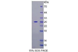 SDS-PAGE analysis of Mouse FPGT Protein. (FPGT Protein)