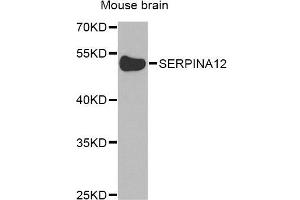 Western blot analysis of extracts of mouse brain, using SERPINA12 Antibody (ABIN5975254) at 1/1000 dilution. (SERPINA12 Antikörper)