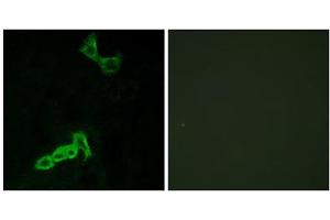 Immunofluorescence analysis of MCF-7 cells, using GPR137C antibody. (GPR137C Antikörper  (Internal Region))
