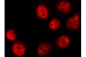 Immunofluorescence (fixed cells) (IF/ICC) image for anti-LIM Domain Kinase 1 (LIMK1) (pThr508) antibody (ABIN6255701)