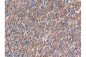 IHC-P analysis of Mouse Stomach Tissue, with DAB staining. (SLIT3 Antikörper  (AA 1348-1517))