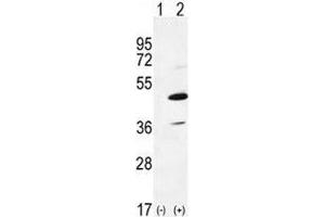 Western blot analysis of IRAK4 antibody and 293 cell lysate either nontransfected (Lane 1) or transiently transfected (2) with the IRAK4 gene. (IRAK4 Antikörper  (AA 5-36))