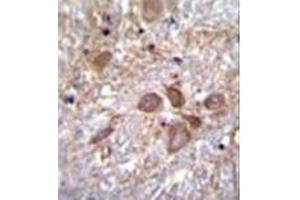 Formalin fixed, paraffin embedded human brain tissue stained with SPECC1 Antibody (Center) followed by peroxidase conjugation of the secondary antibody and DAB staining.