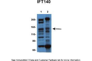 Sample Type: 1. (IFT140 Antikörper  (N-Term))