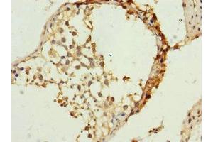 Immunohistochemistry of paraffin-embedded human testis tissue using ABIN7159905 at dilution of 1:100 (TIMM23 Antikörper  (AA 1-209))