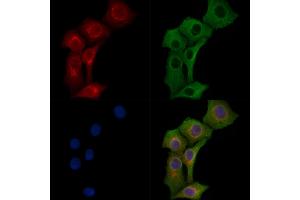 ABIN7094455 and ABIN7098503 staining Hela cells by IF/ICC.