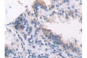 Immunohistochemistry (IHC) image for anti-Fibulin 1 (FBLN1) (AA 176-398) antibody (ABIN7434947)
