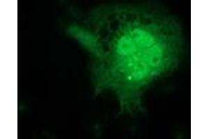 Anti-FGF21 mouse monoclonal antibody (ABIN2454488) immunofluorescent staining of COS7 cells transiently transfected by pCMV6-ENTRY FGF21 (RC204538). (FGF21 Antikörper  (AA 29-209))