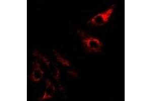 Immunofluorescent analysis of SPINK1 staining in Hela cells. (SPINK1 Antikörper)