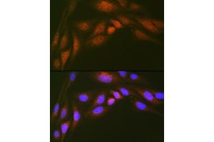 Immunofluorescence (IF) image for anti-Ubiquitin-Conjugating Enzyme E2N (UBE2N) antibody (ABIN7271179)