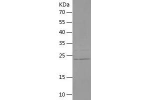 Western Blotting (WB) image for Fibroblast Growth Factor 8 (Androgen-Induced) (FGF8) (AA 53-233) protein (His tag) (ABIN7283455) (FGF8 Protein (AA 53-233) (His tag))