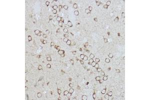 Immunohistochemistry (IHC) image for anti-Ionized Calcium-binding Adapter Molecule 1 (IBA1) (AA 1-147) antibody (ABIN6136676)
