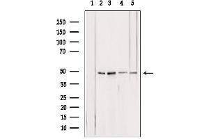 Western blot analysis of extracts from various samples, using ATPB antibody. (ATP5B Antikörper  (Internal Region))
