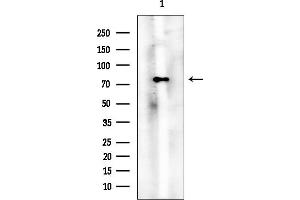 anti-Protein Kinase C, beta 1 (Pkc beta 1) (C-Term) antibody