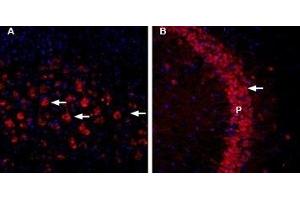 Immunohistochemistry (IHC) image for anti-Calcium Homeostasis Endoplasmic Reticulum Protein (CHERP) (AA 669-684), (Cytosolic) antibody (Atto 594) (ABIN7043012)