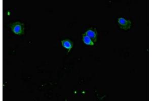 Immunofluorescent analysis of Hela cells using ABIN7148148 at dilution of 1:100 and Alexa Fluor 488-congugated AffiniPure Goat Anti-Rabbit IgG(H+L) (CCDC8 Antikörper  (AA 214-513))