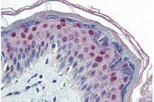 Human Skin (formalin-fixed, paraffin-embedded) stained with CEBPB antibody ABIN364320 at 10 ug/ml followed by biotinylated anti-mouse IgG secondary antibody ABIN481714, alkaline phosphatase-streptavidin and chromogen. (CEBPB Antikörper)