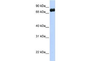 WB Suggested Anti-LRCH4 Antibody Titration:  0. (LRCH4 Antikörper  (N-Term))