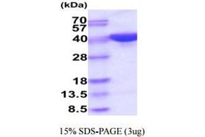 SDS-PAGE (SDS) image for Pregnancy Specific beta-1-Glycoprotein 5 (PSG5) (AA 35-335) protein (His tag) (ABIN6388077) (PSG5 Protein (AA 35-335) (His tag))